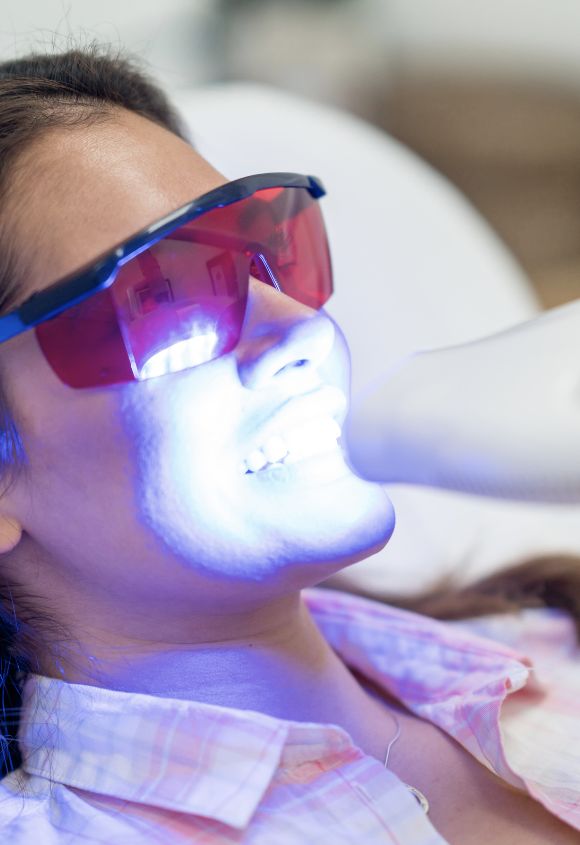 blanqueamiento-dental-en-clinica-zoom-albacete-raga