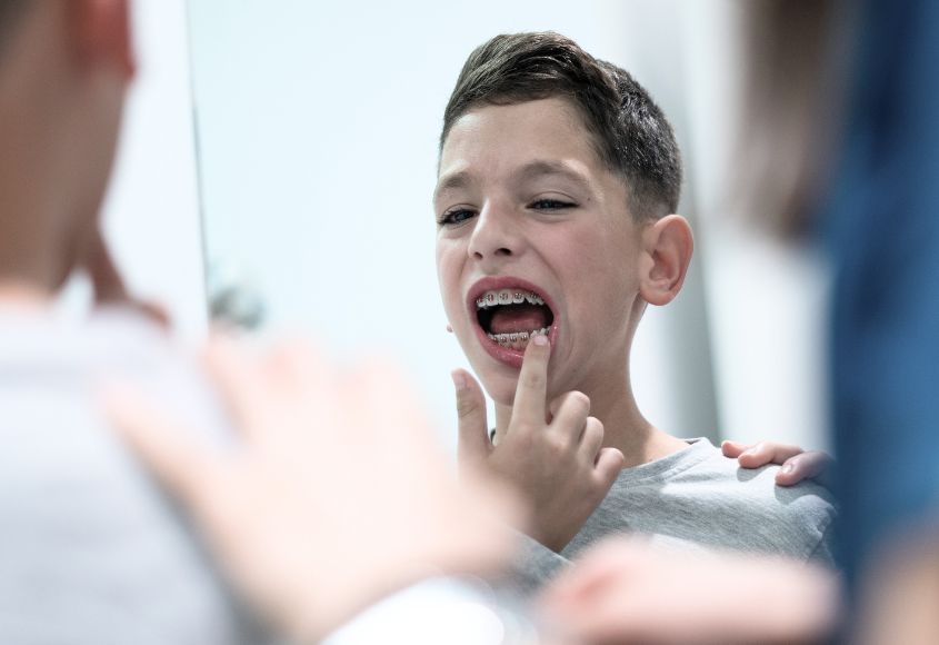brackets-tradicionales-en-albacete