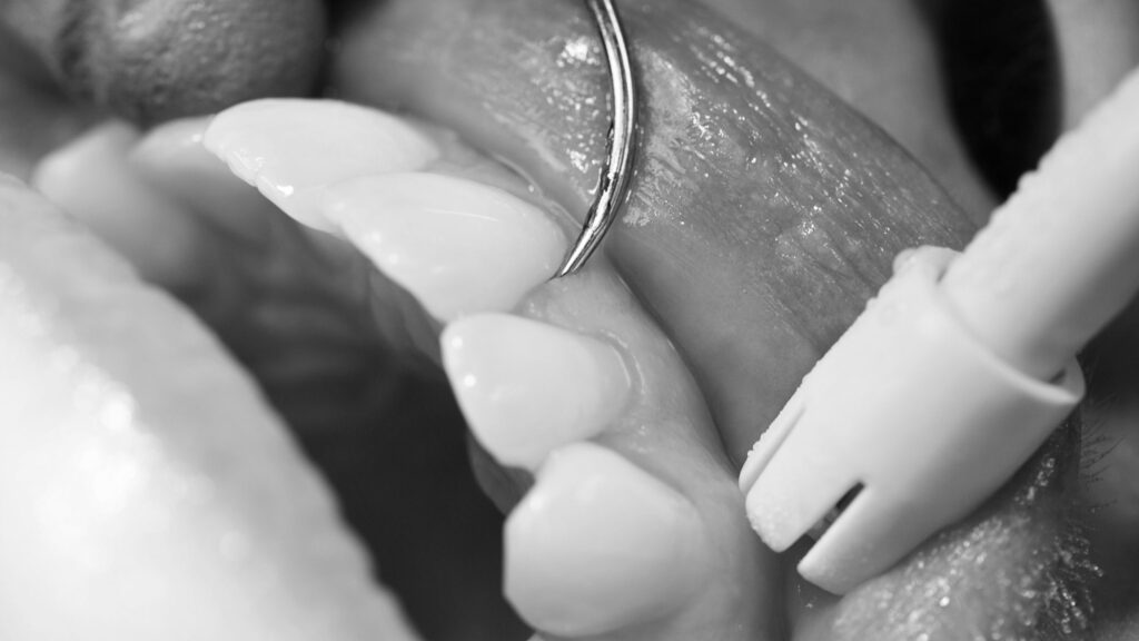 periodoncia-albacete-clinica-raga