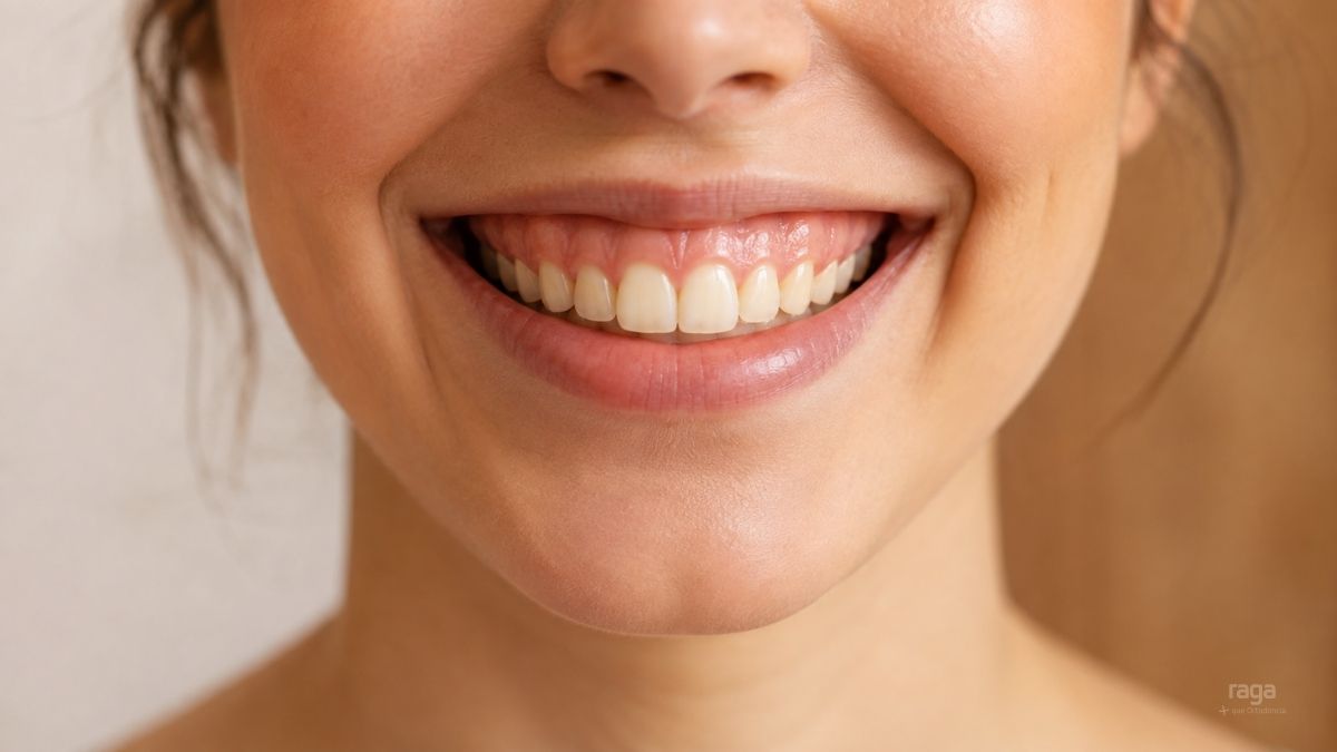 Sonrisa gingival y cómo tratarla en Raga Albacete
