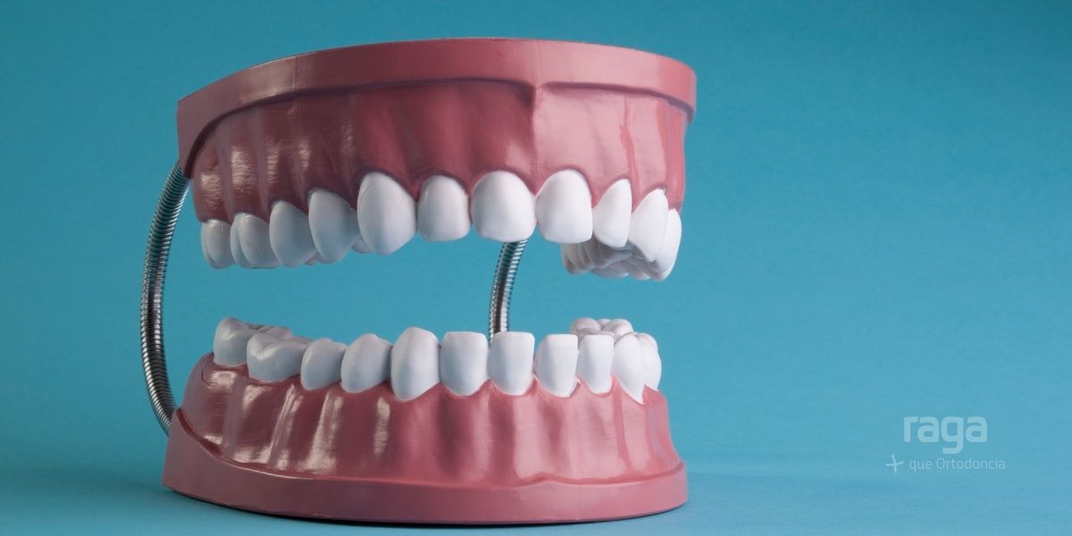 Encías desiguales o desproporcionadas, tipos y soluciones