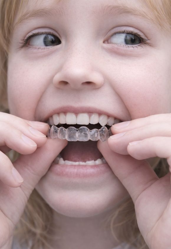 Ortodoncia invisible para niños en Raga Albacete
