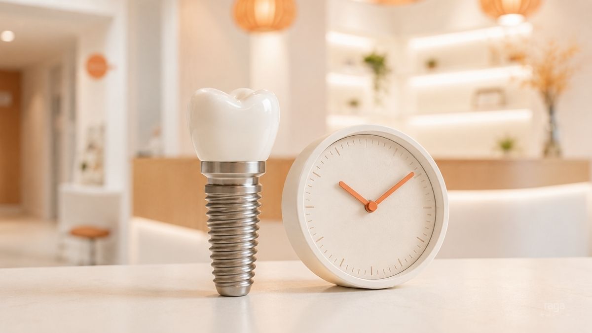 Cuánto dura un implante dental